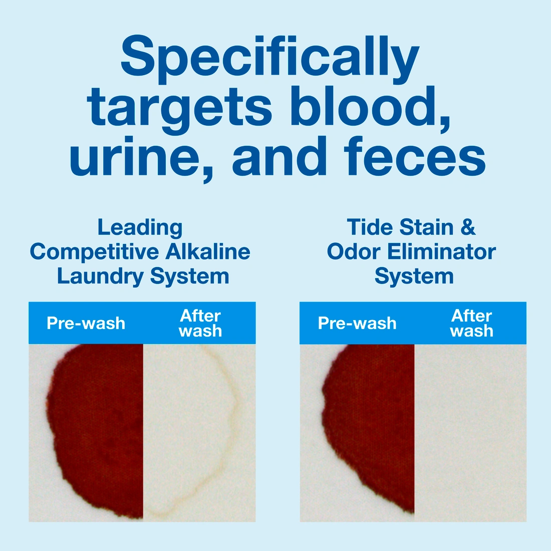 Protex - For Protein Stains: Blood, Milk, Eggs, Vomit, Urine