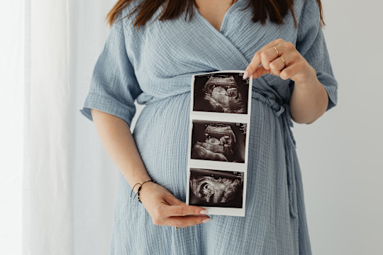 Brief Guide to the Latest U.S. Federal Protections for Pregnant and Nursing Employees card image