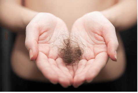 A ball of brown hair in palms