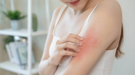 5 Ways To Soothe Sensitive Skin - Image - Johnson's Adult - ar-AE