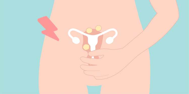「子宮筋腫」ってどんな病気?手術が必要なの?