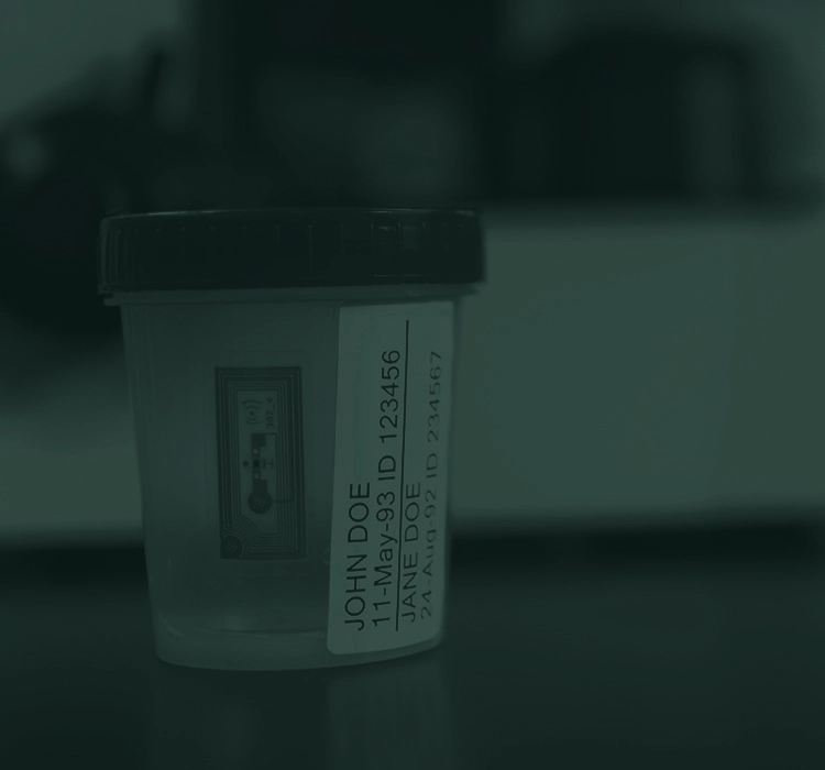 Specimen cup. 