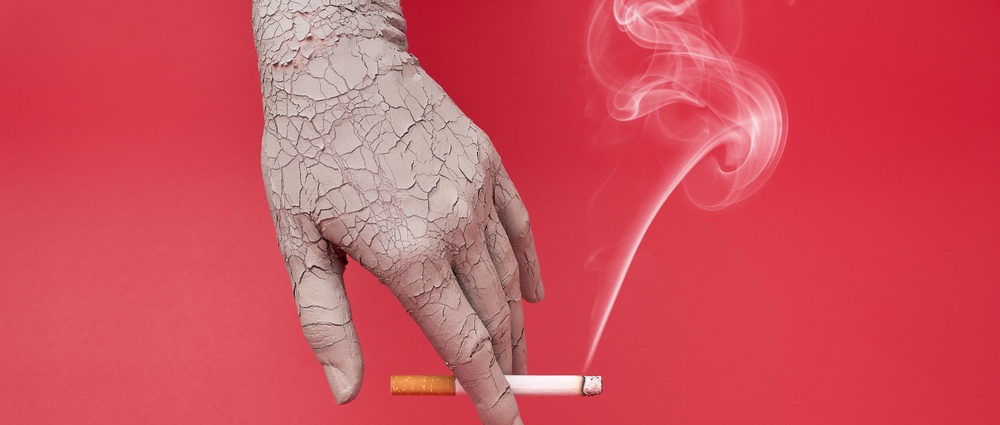 Smoking cigarette in a dry and cracked hand, bad effects of smoking on skin.