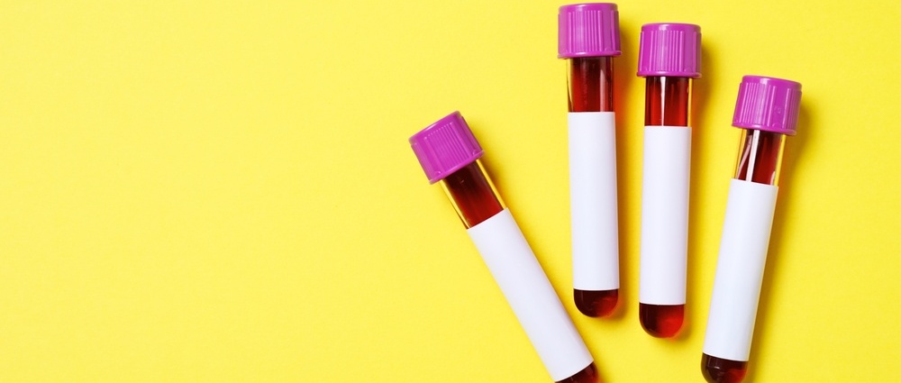 Empty test tubes on yellow background, flat lay. 
