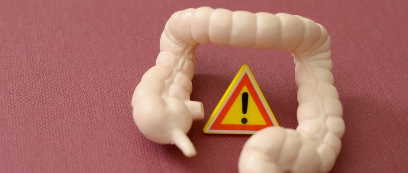 What you need to know about bowel screening