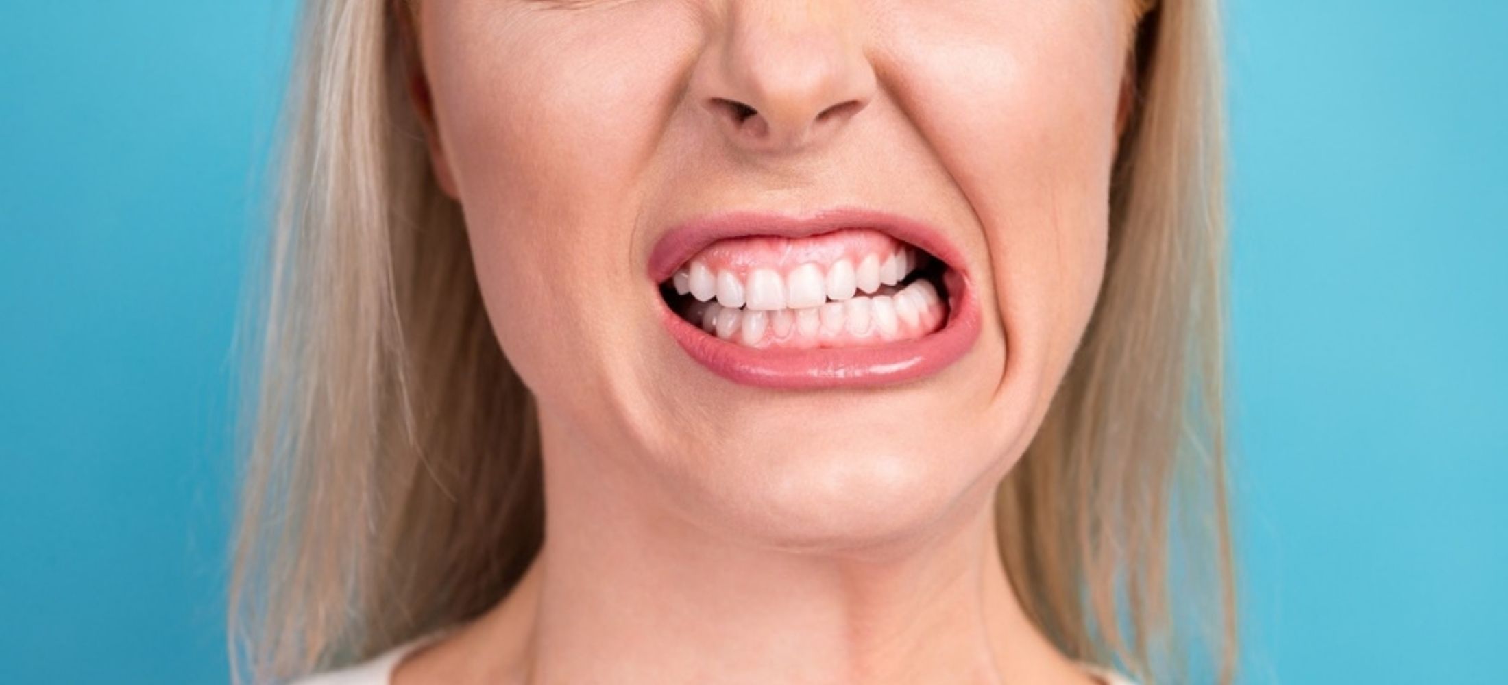 Close-up portrait of a woman baring and clenching her teeth in a tense grimace, conveying stress, frustration, jaw pain, and dental focus against a blue background.