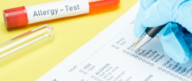 Cropped view of woman in latex glove filling in allergy test form near test tubes with allergy test lettering isolated on yellow background.