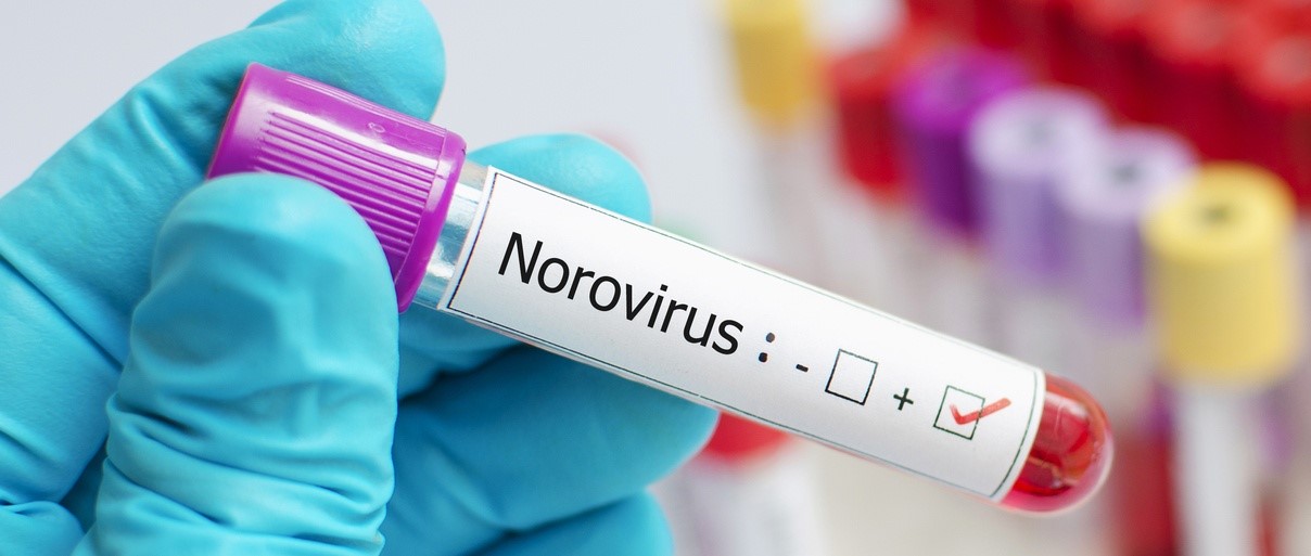 Norovirus - when to see a doctor