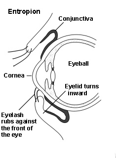 Entropion, also known as eyelid rolls