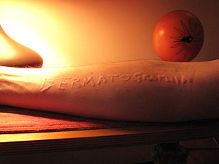 Dermatographic urticaria