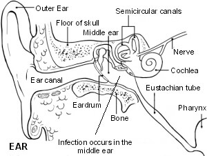 The ear showing otitis media