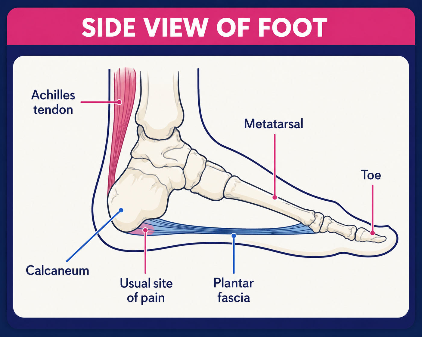 Heel - plantar fascia