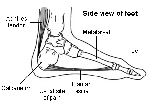 Heel - plantar fascia