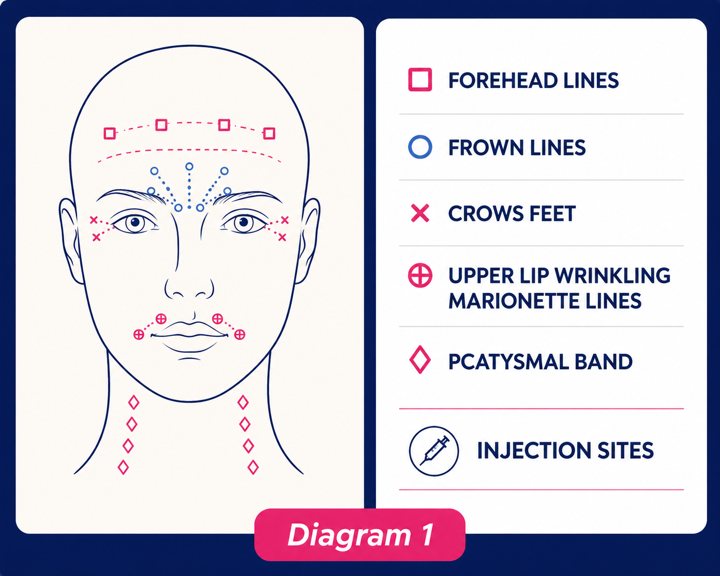 Botox injections