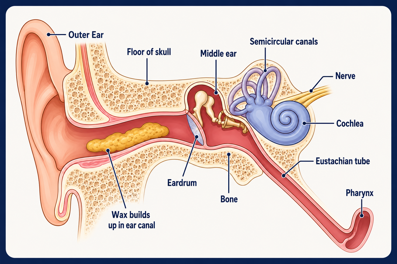 Earwax in ear canal