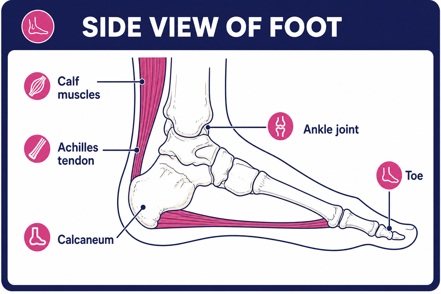 Foot - Achilles Tendon