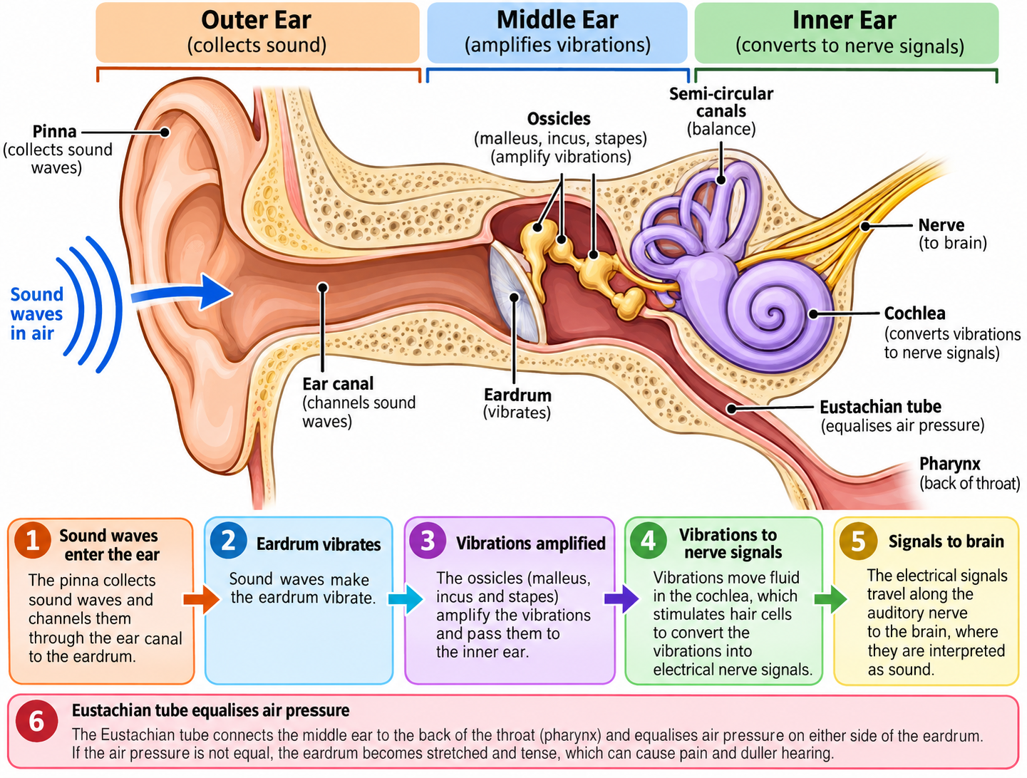Ear - barotrauma