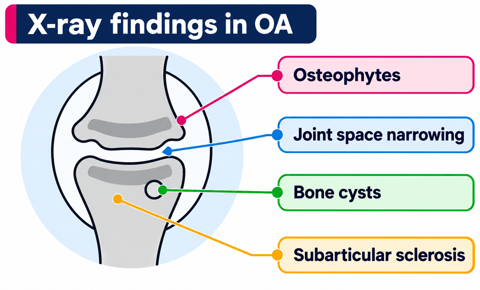 Osteoarthritis X-ray