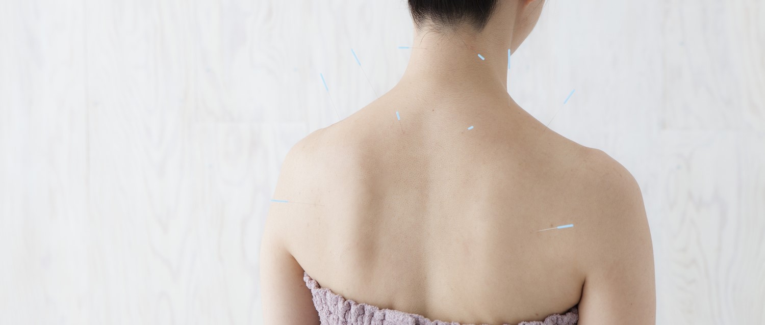 Can acupuncture help you get pregnant?