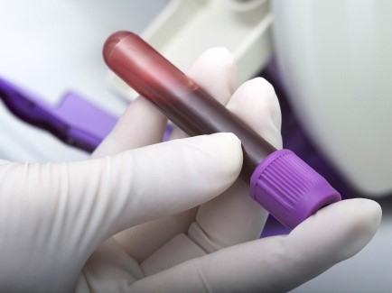 Blood clotting tests
