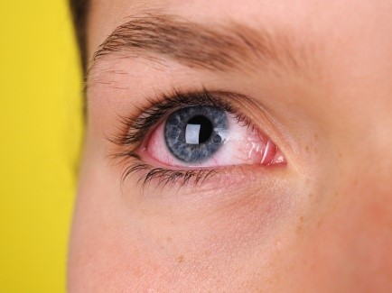 eye problems