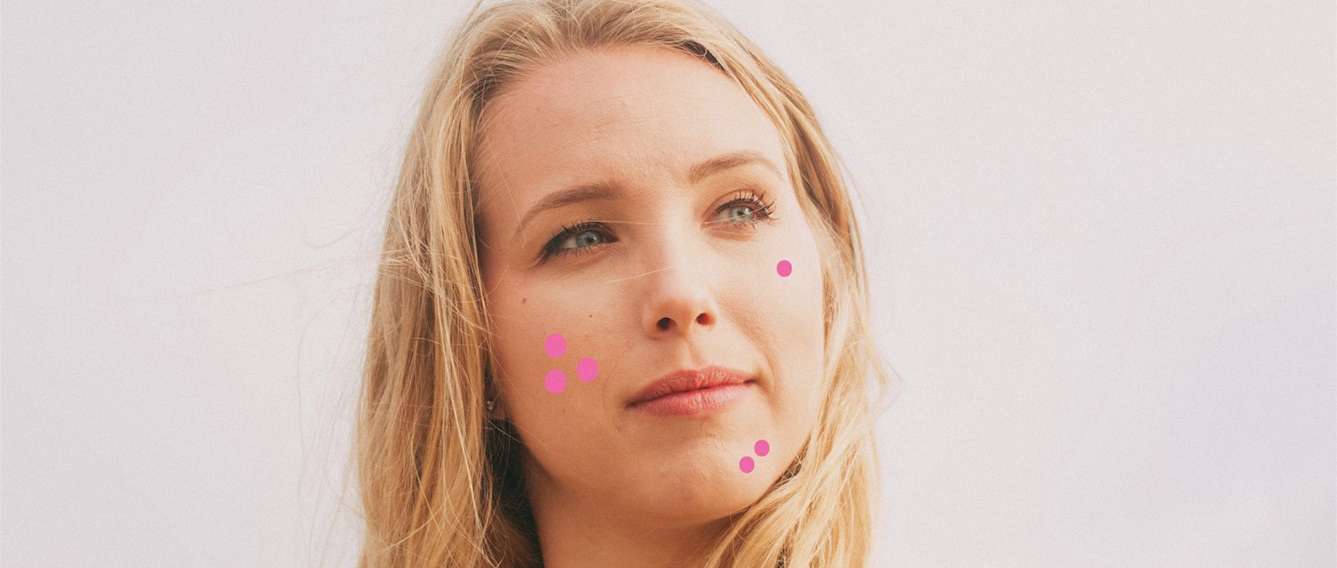 How to tell the difference between acne and other skin problems