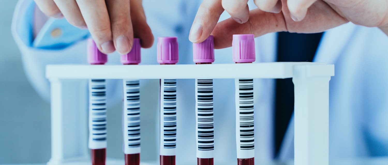 Full Blood Count FBC Uses and Normal Ranges