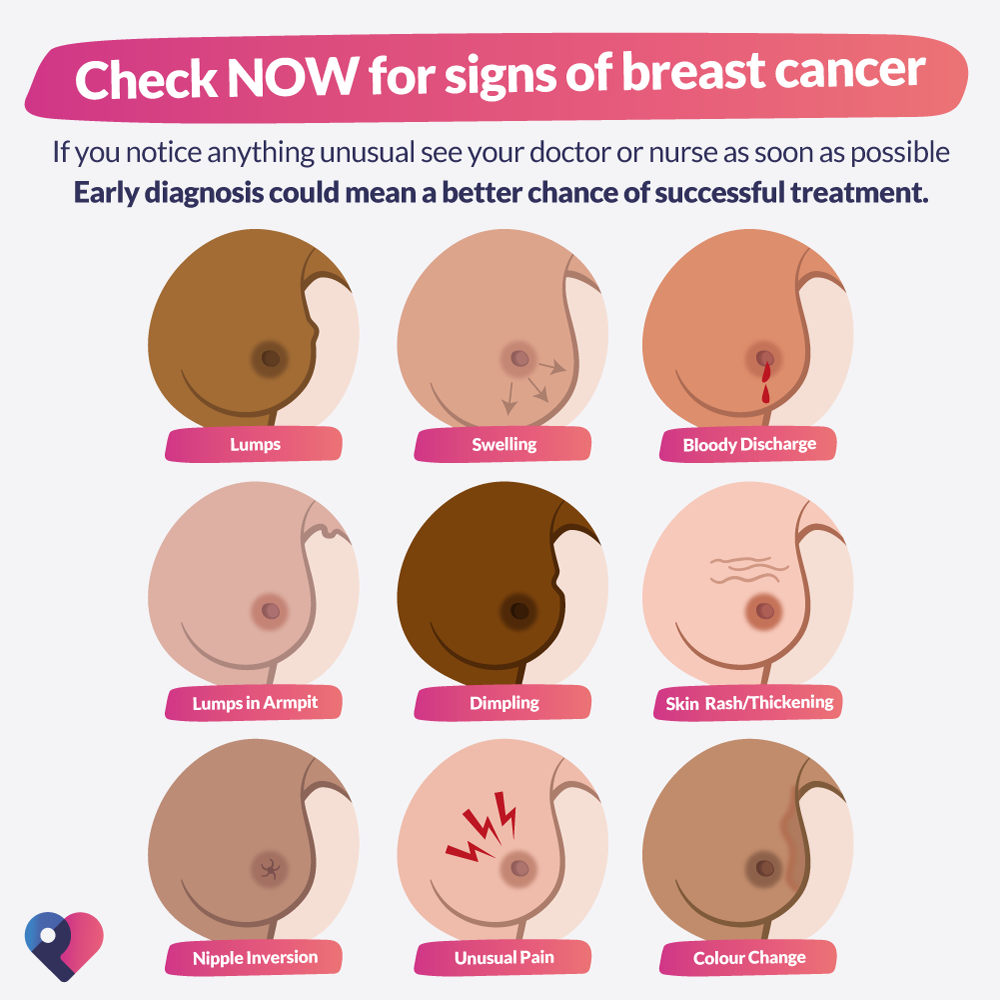 How to check your breasts