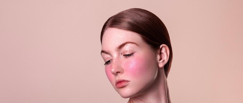 rosacea couperose redness skin, red spots on cheeks, young beautiful red-haired woman with sensitive skin, patient face close-up isolated on beige background