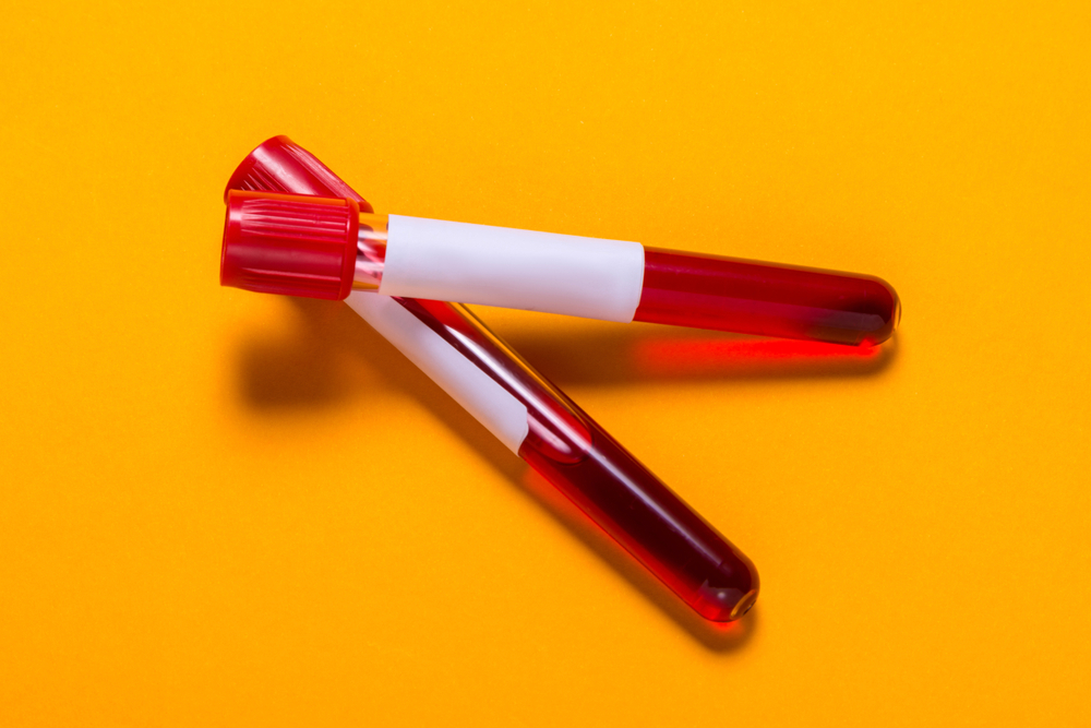 Vials of blood with blank labels against yellow/orange background.