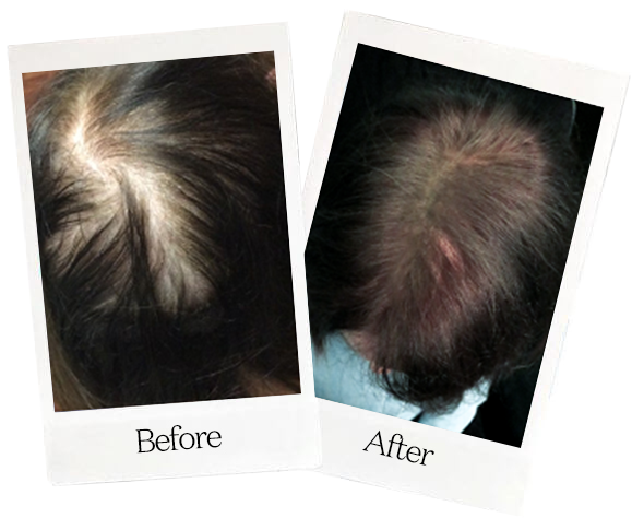 best-hair-growth-companies-of-2023-favy