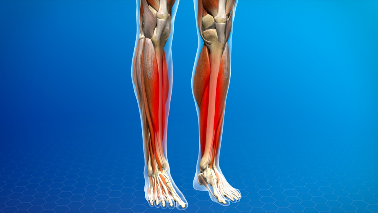 Shin Splints: How to Prevent Them, and Get Them Gone for Good!