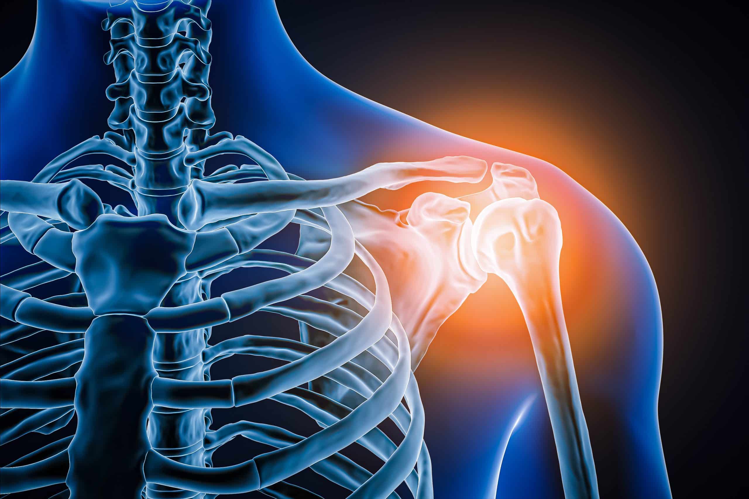 An Athlete's Guide to Joint Pain - A Crash Course