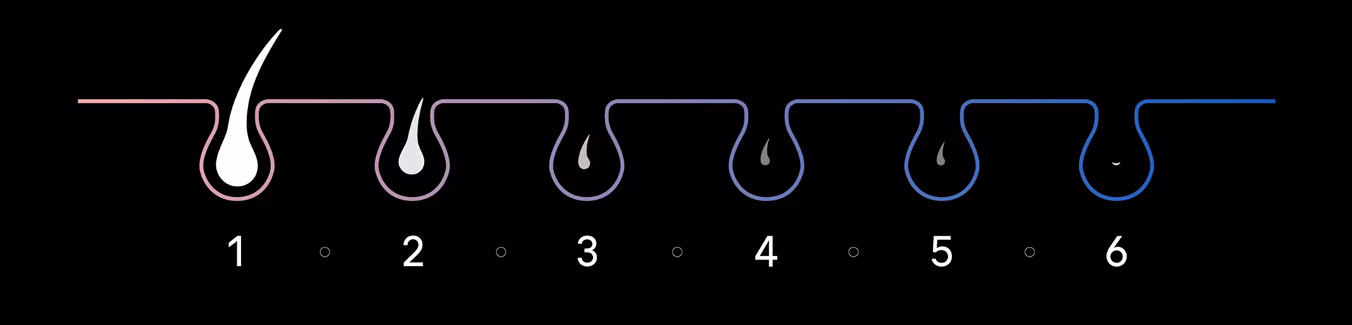 Graphique montrant les poils de la peau entre la première et la sixième séance, illustrant la réduction visible des poils. Graphique montrant les poils de la peau entre la première et la sixième séance, illustrant la réduction visible des poils.