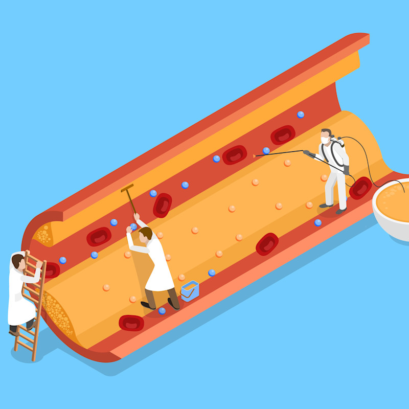 Why every patient needs a CAC score—no matter their age MDLinx