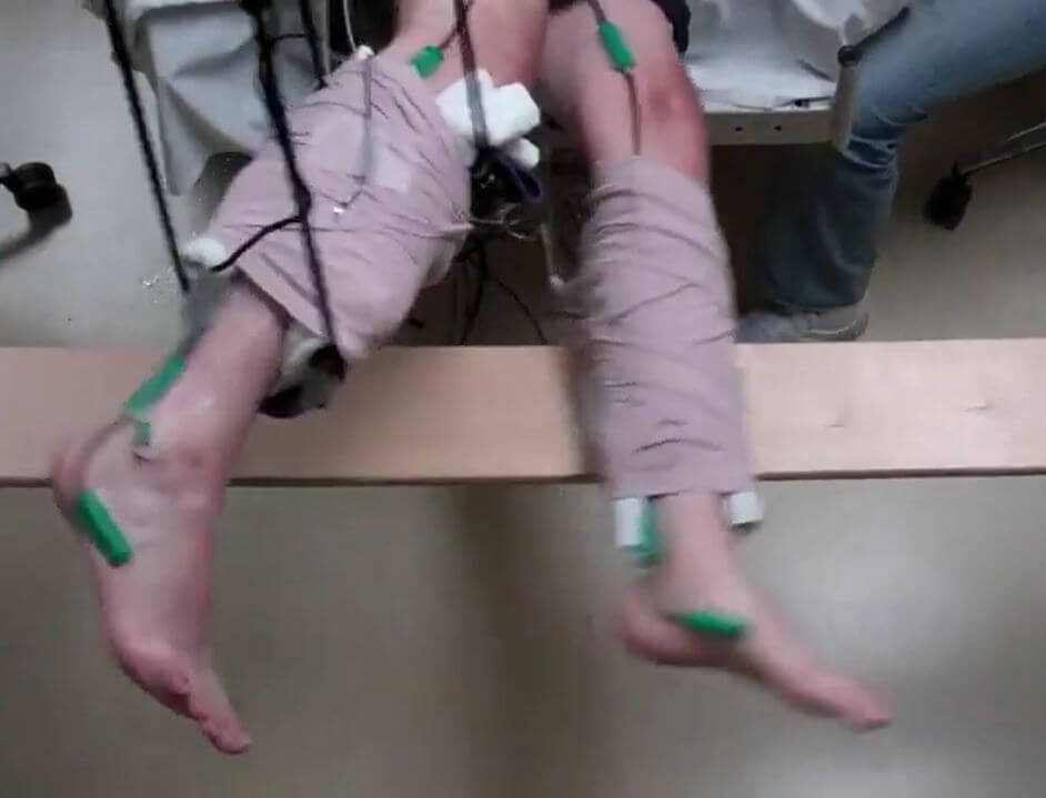 Paralysis Leg Therapy