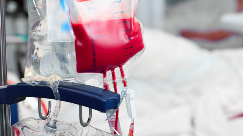 Blood transfusions may lead to worse outcomes after nephrectomy for RCC ...