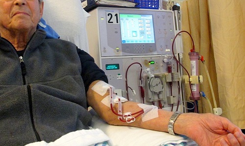 Conservative Care Is As Good As Dialysis For Elderly Kidney Failure Patients Mdlinx