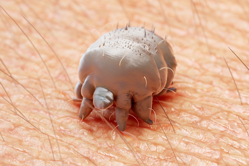 These tiny parasites may be crawling on your skin right now | MDLinx