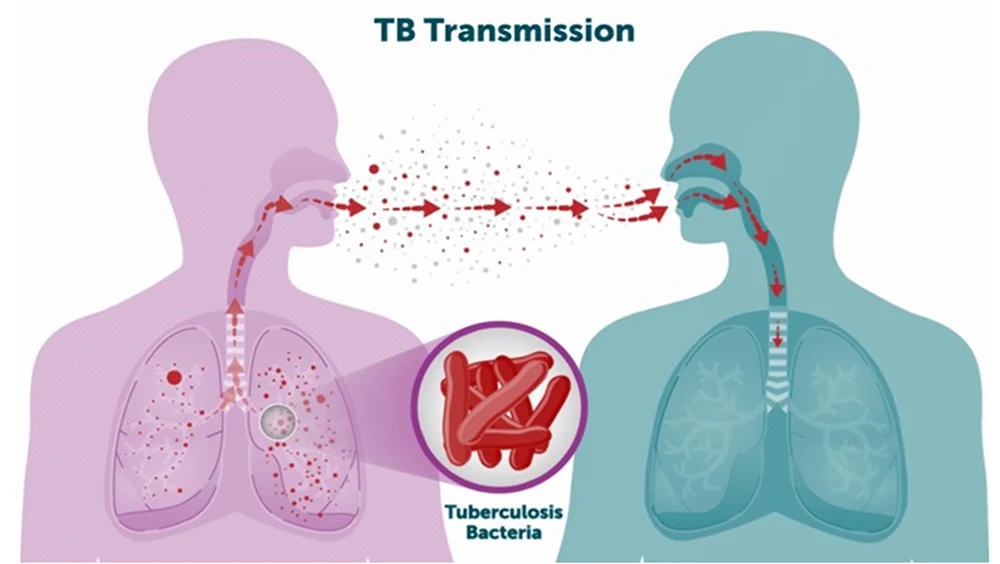 Illustration showing airborne tuberculosis bacteria transmission between people