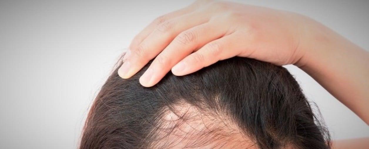 ¿Qué vitaminas se deben tomar para evitar la caída del pelo?