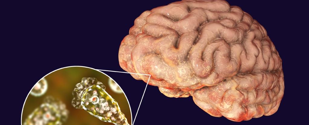 Estados Unidos: niño de 2 años fallece producto de una ameba 'come cerebros'