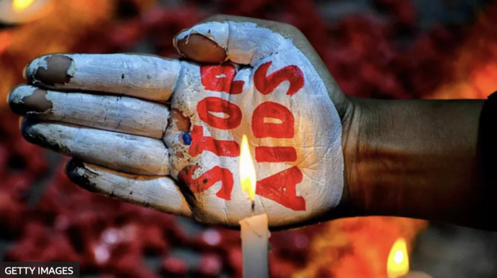 La ONU asegura que el mundo está en camino de eliminar el sida para 2030