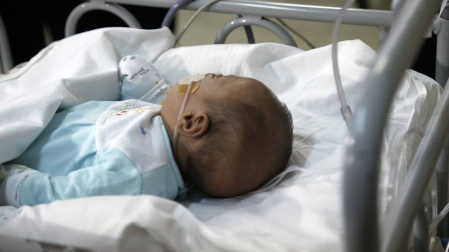 Virus sincicial: 218 guaguas son trasladadas por crítico estado de salud