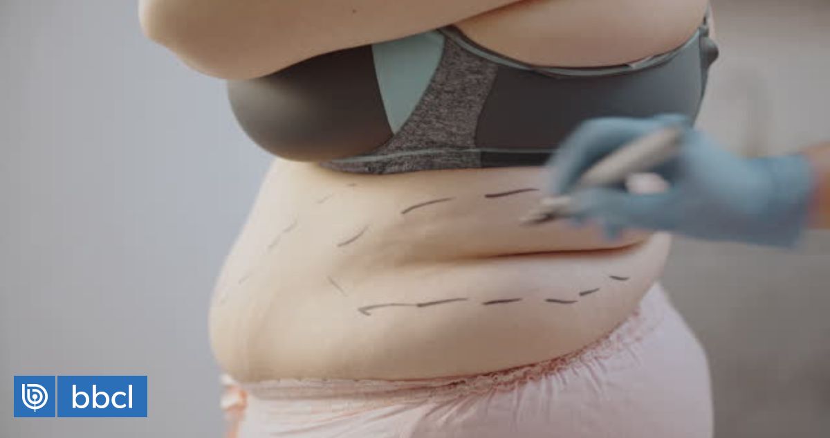 Avanza proyecto que regula cirugías estéticas: limita su ejercicio a médicos cirujanos acreditados