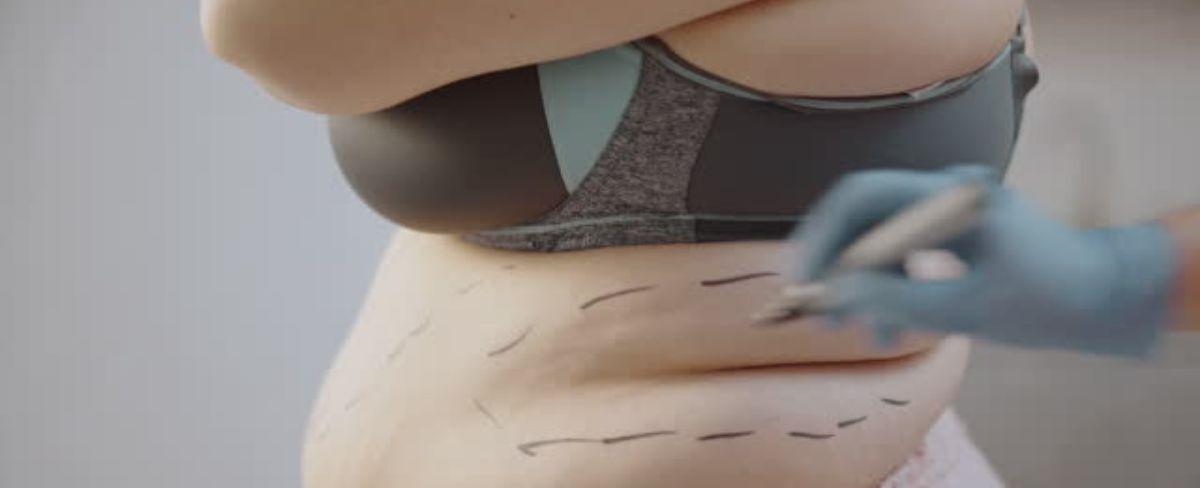 Avanza proyecto que regula cirugías estéticas: limita su ejercicio a médicos cirujanos acreditados