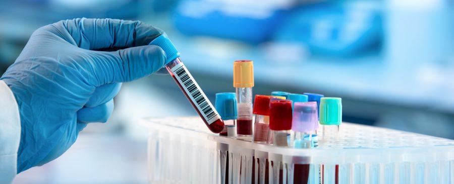 “No se parece a nada visto antes”: La subvariante de Covid que preocupa a la OMS