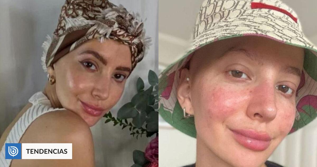 "No todos tenemos las mismas posibilidades": Aylén Milla reflexiona sobre la salud mental y el cáncer