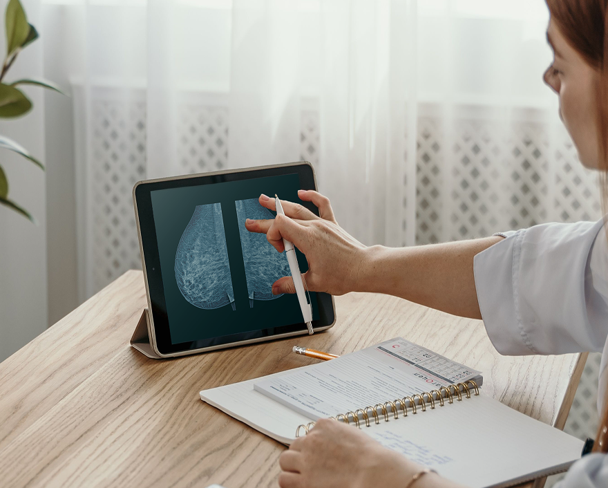 Clinician holding up a mammogram image