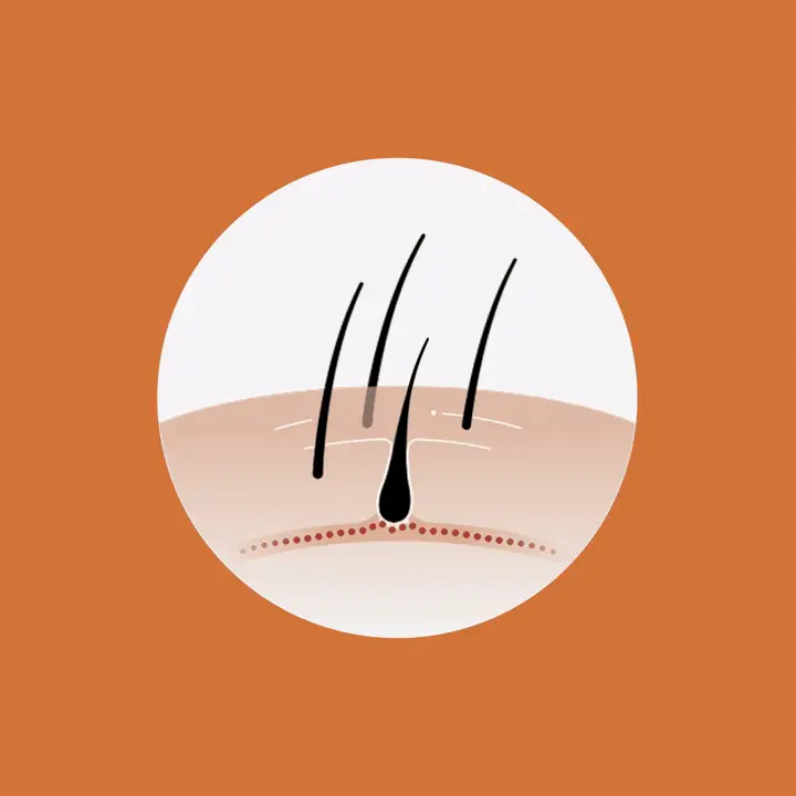 New growth appearing after hair loss treatment plan takes action